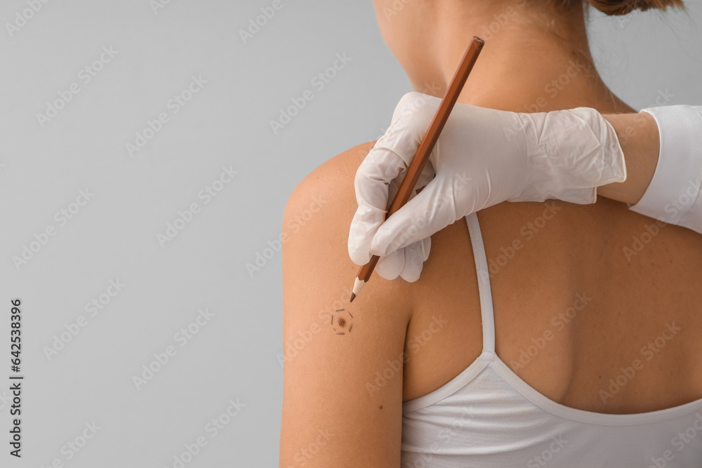 Dermatologist marking young womans mole on light background, closeup