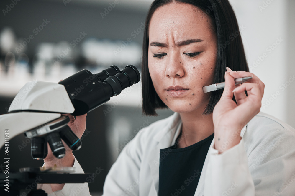 Microscope, scientist and stress of woman in laboratory, research challenge or angry. Science, medical professional and frustrated Asian person fail in experiment test, tired or mistake in healthcare