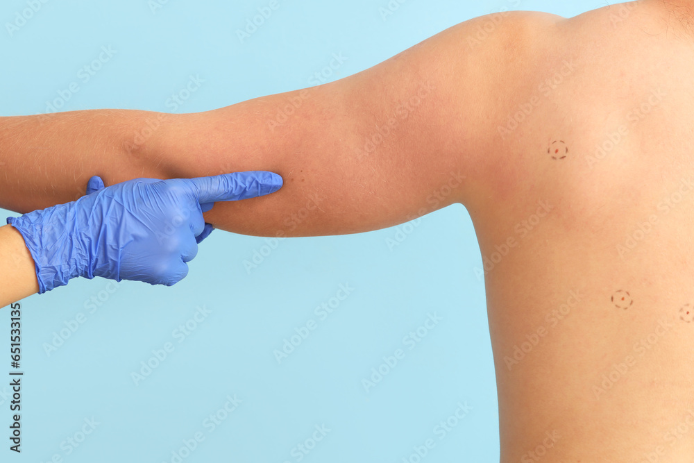 Dermatologist pointing at moles on young mans arm against blue background, back view