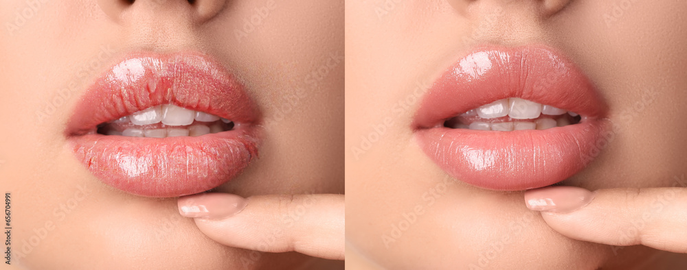 Young woman with beautiful lips on light background, closeup