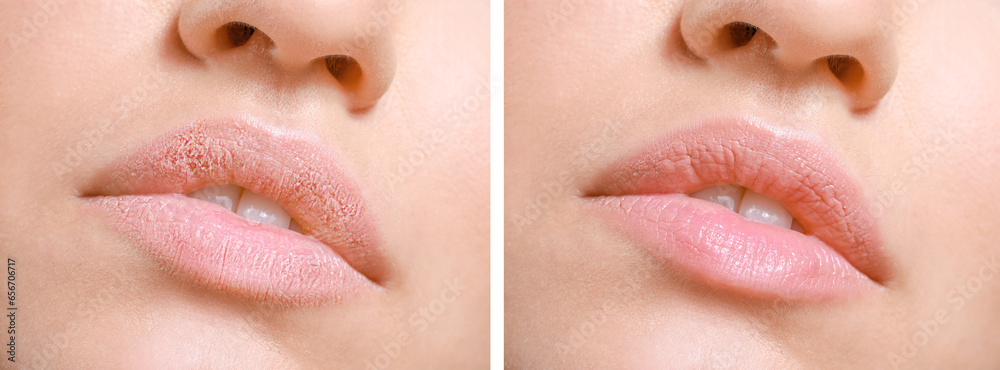 Young woman with beautiful lips, closeup